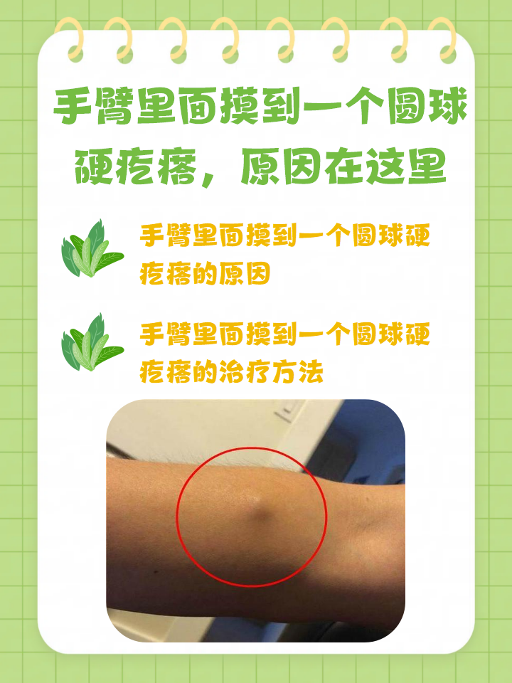 纤维瘤是怎么形成的