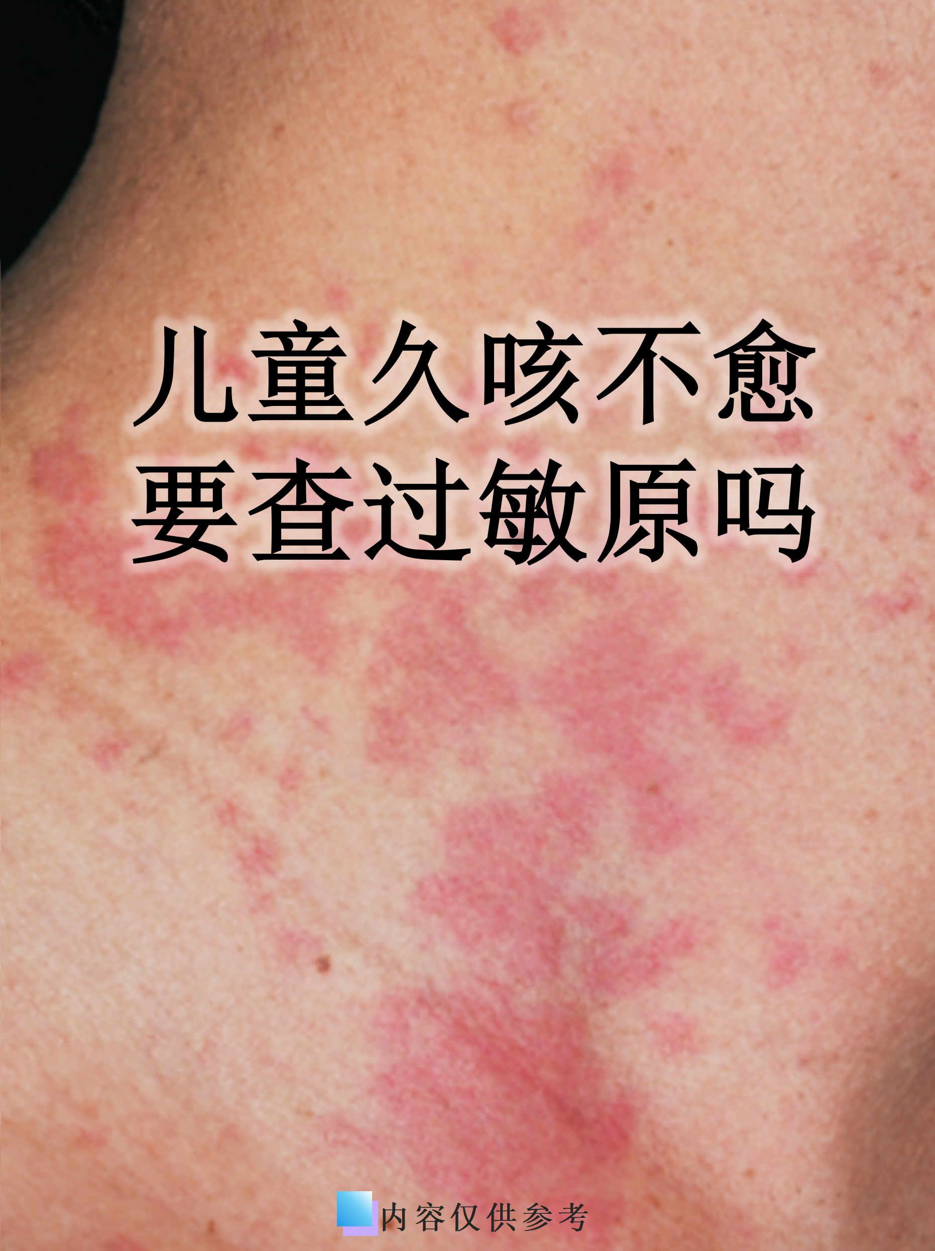 病毒性感冒几天能好