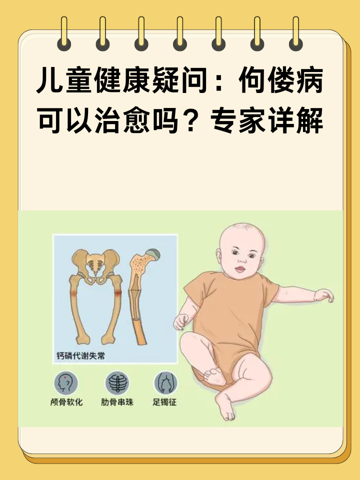 什么是佝偻病?