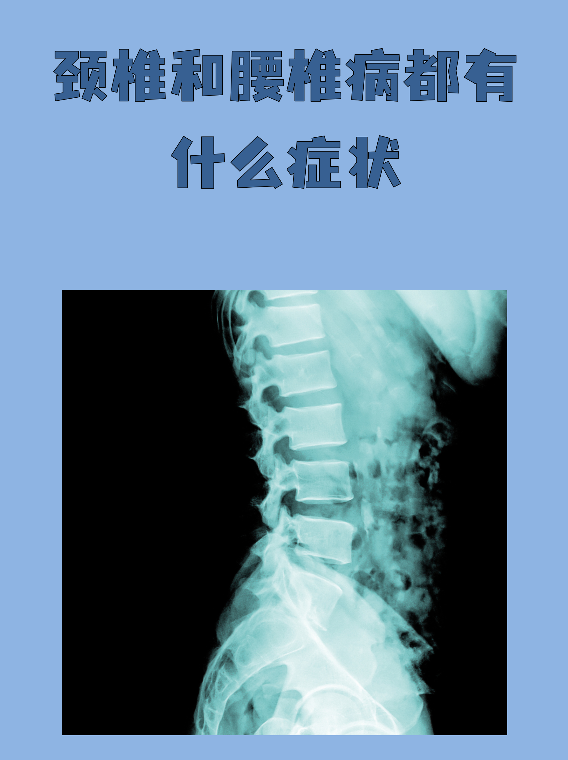 脊柱关节病包括哪些