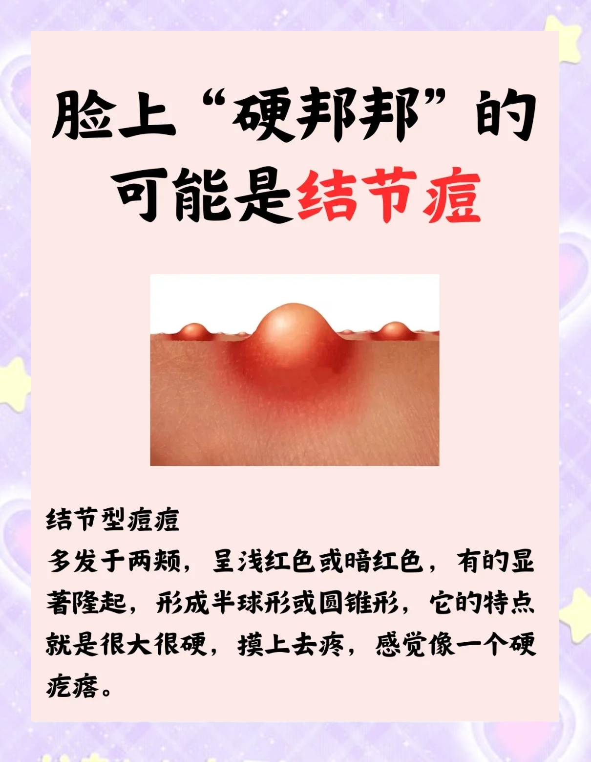 脸上长了囊肿怎么办