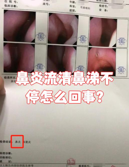 黄绿色鼻涕是怎么回事