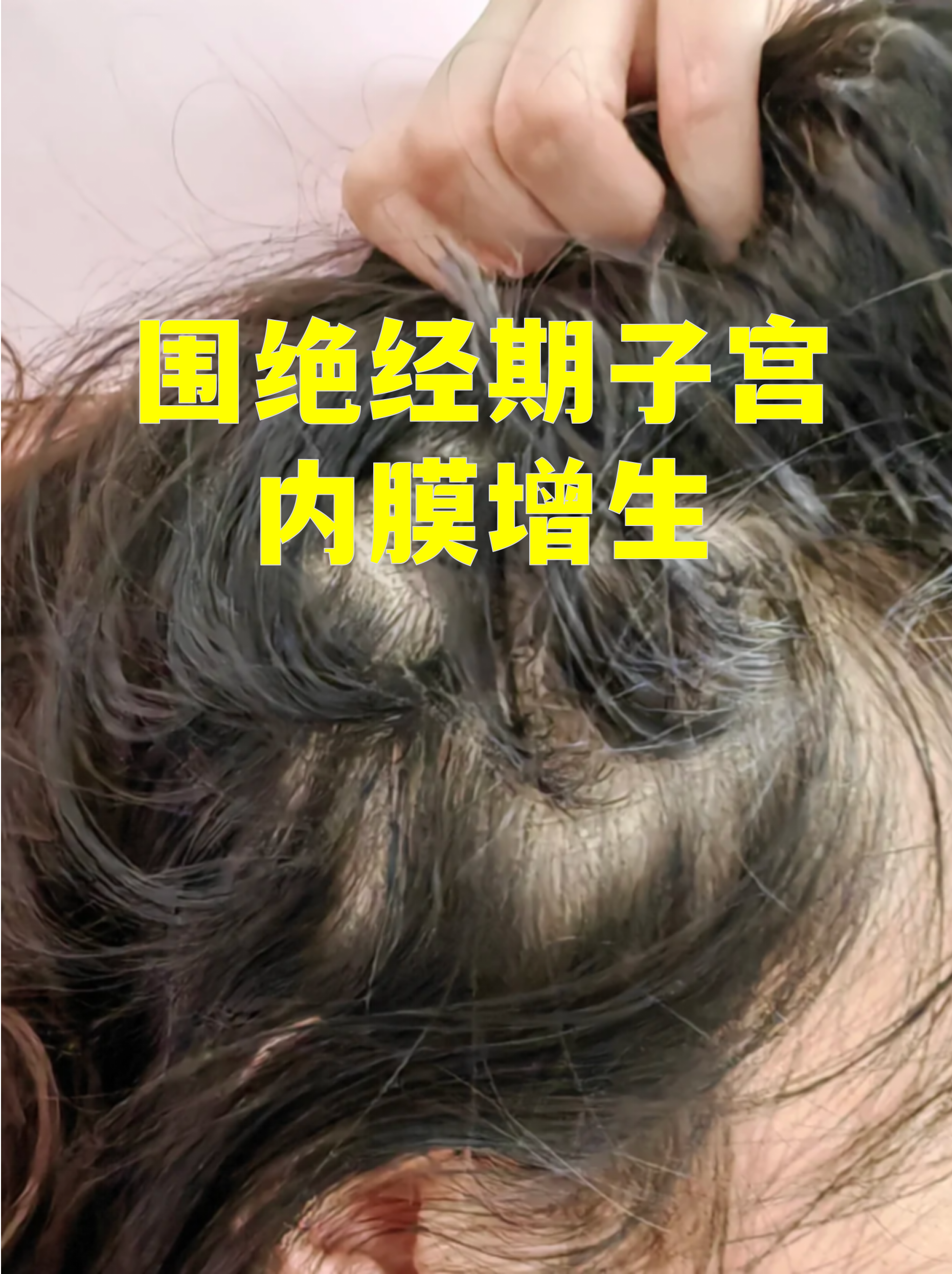 什么事宫颈增生