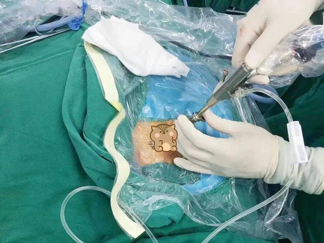 腰椎间盘突出手术