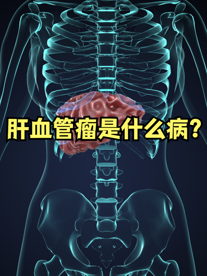 什么是肝血管瘤