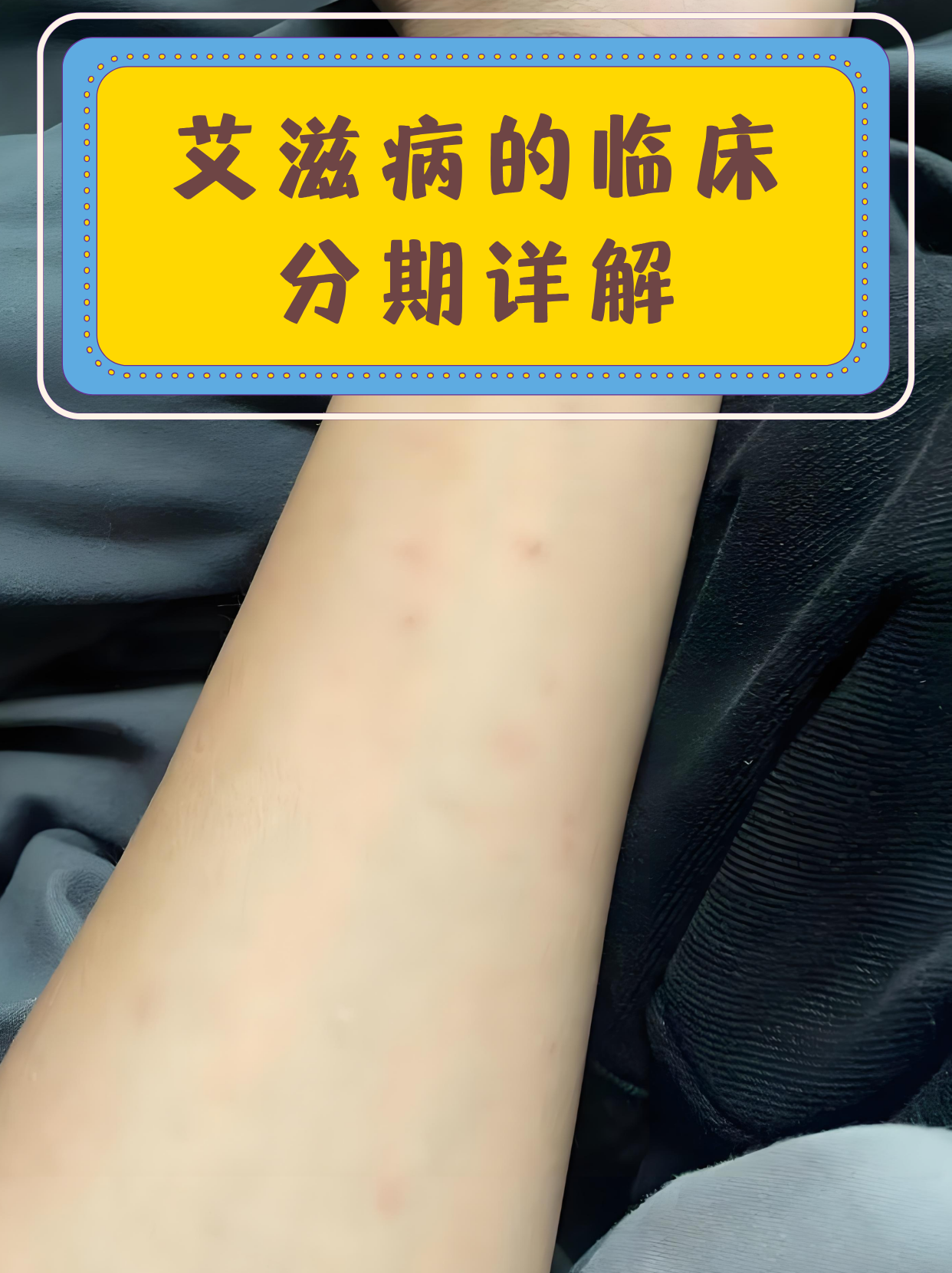 经常感冒是得艾滋了吗?