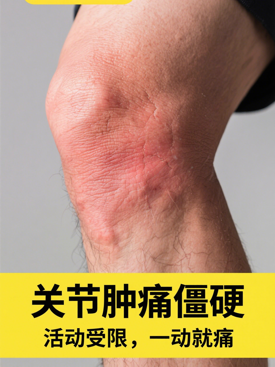 醋氯芬酸分散片