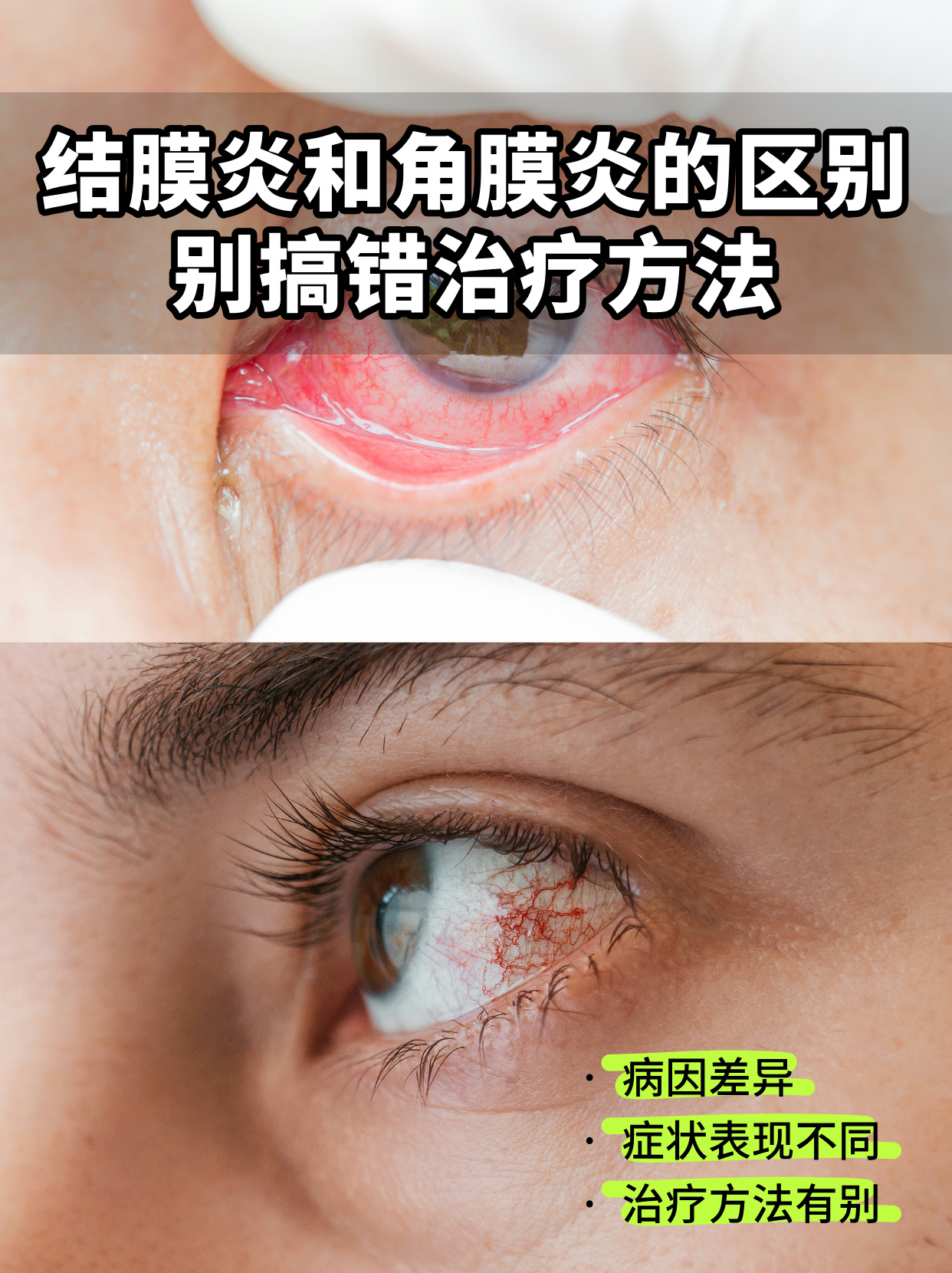 结膜炎什么原因导致的