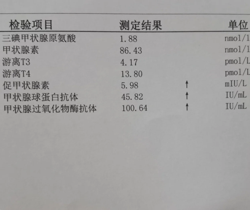 甲状腺球蛋白抗体高严重吗?