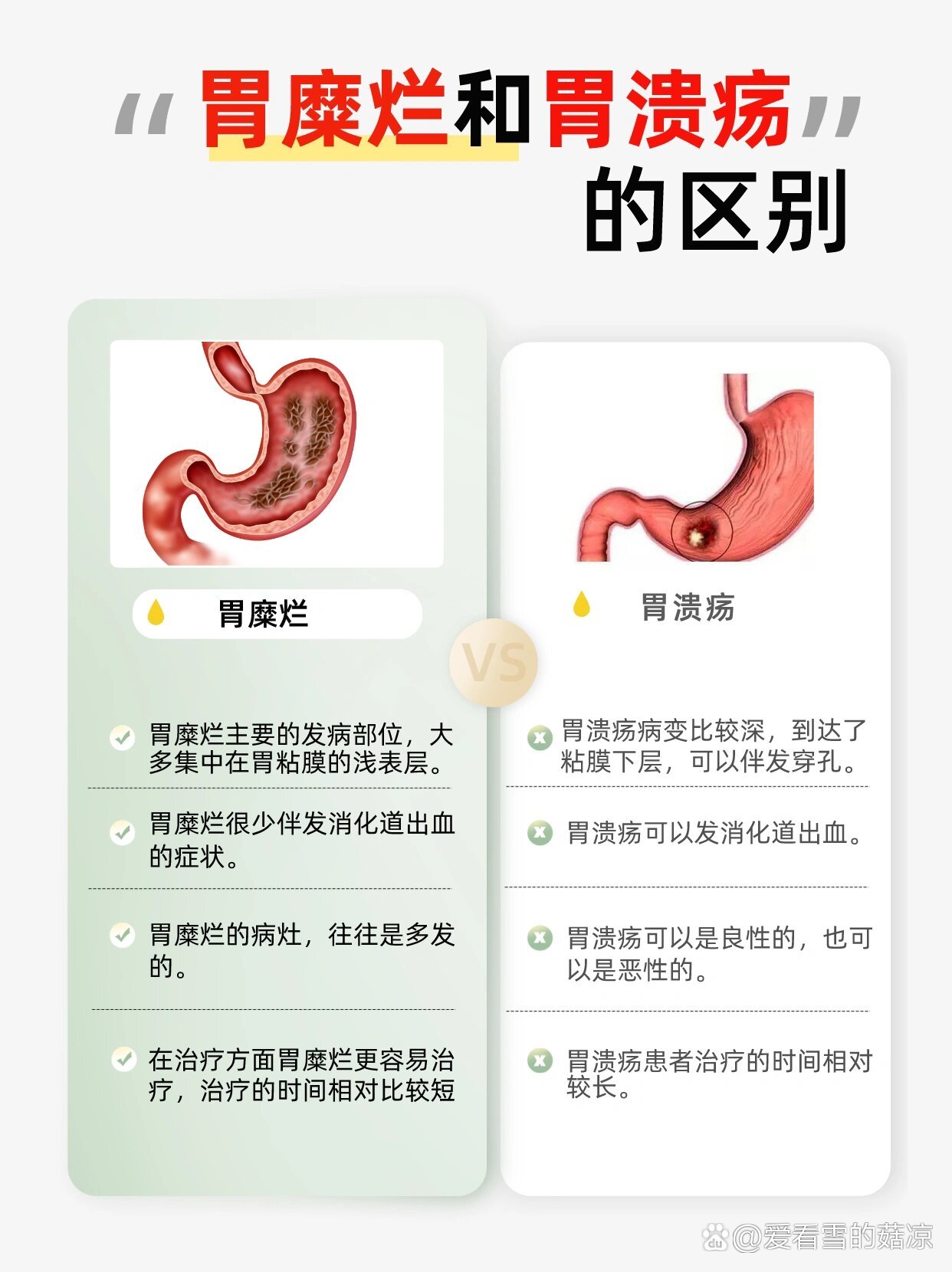 胃溃疡和十二指肠溃疡的区别有哪些