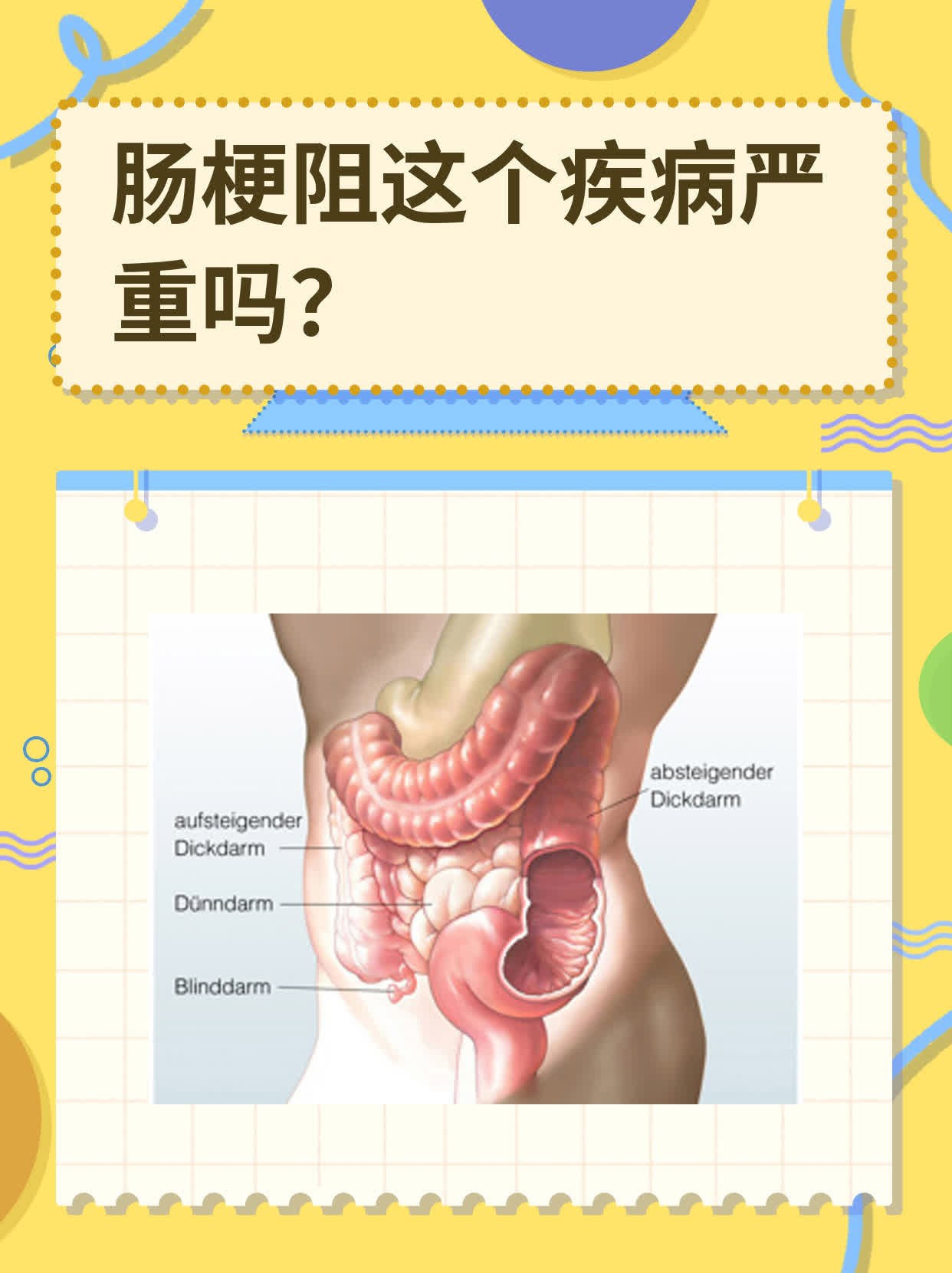 肠梗阻的临床症状有哪些