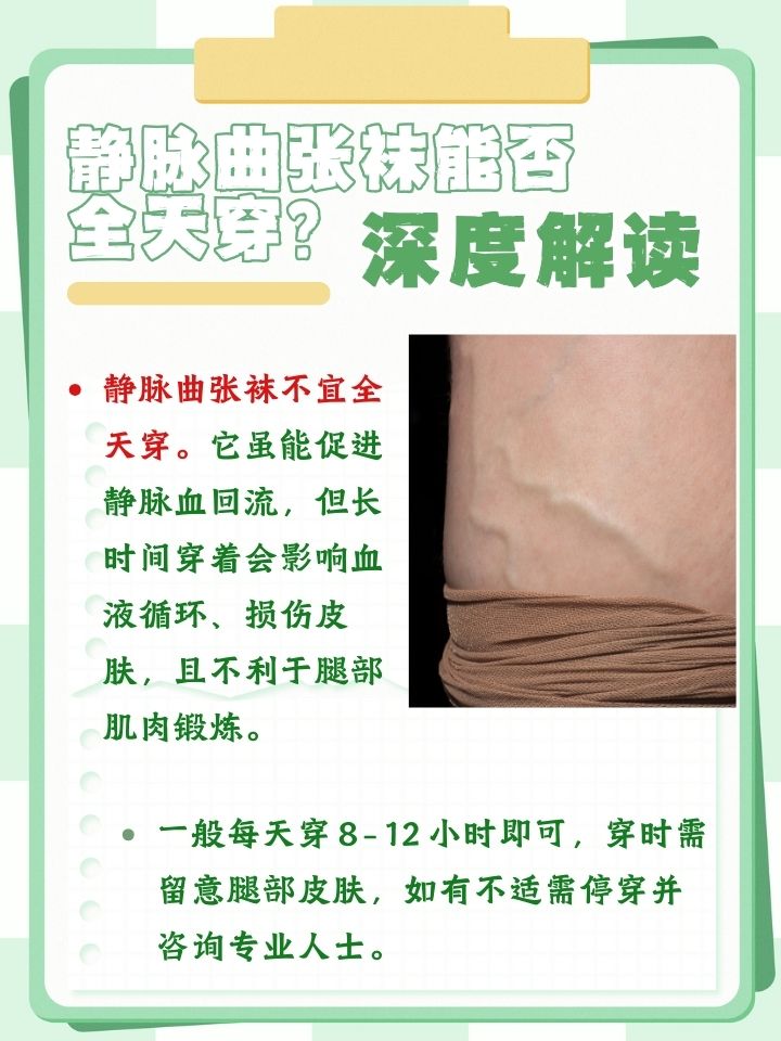 静脉曲张袜有用吗