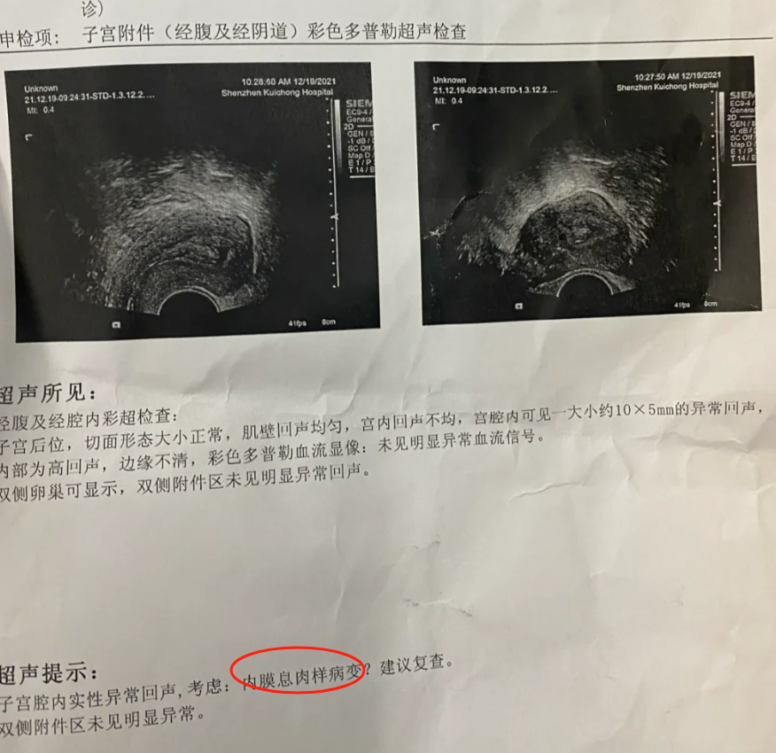 子宫内膜增厚是什么