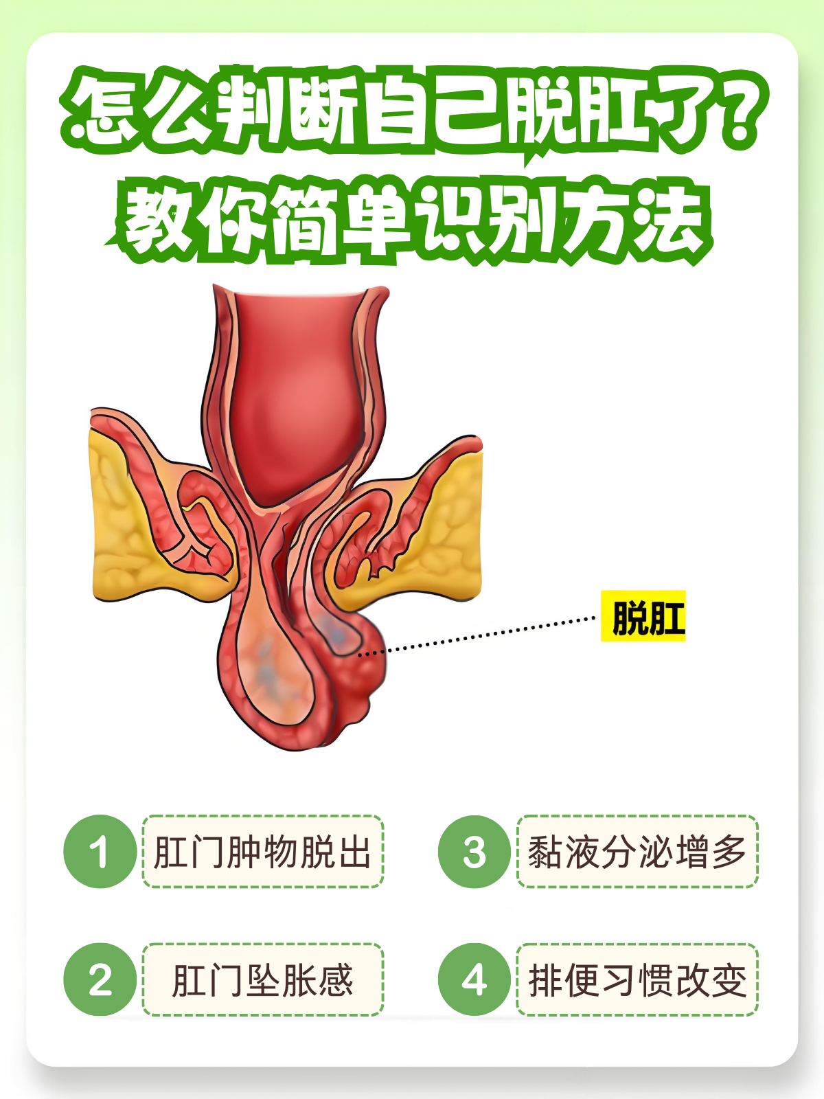 脱肛了该怎么办