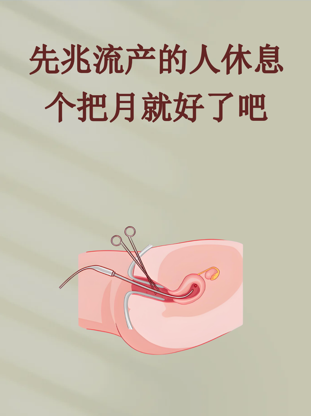 先兆流产一定会流产吗