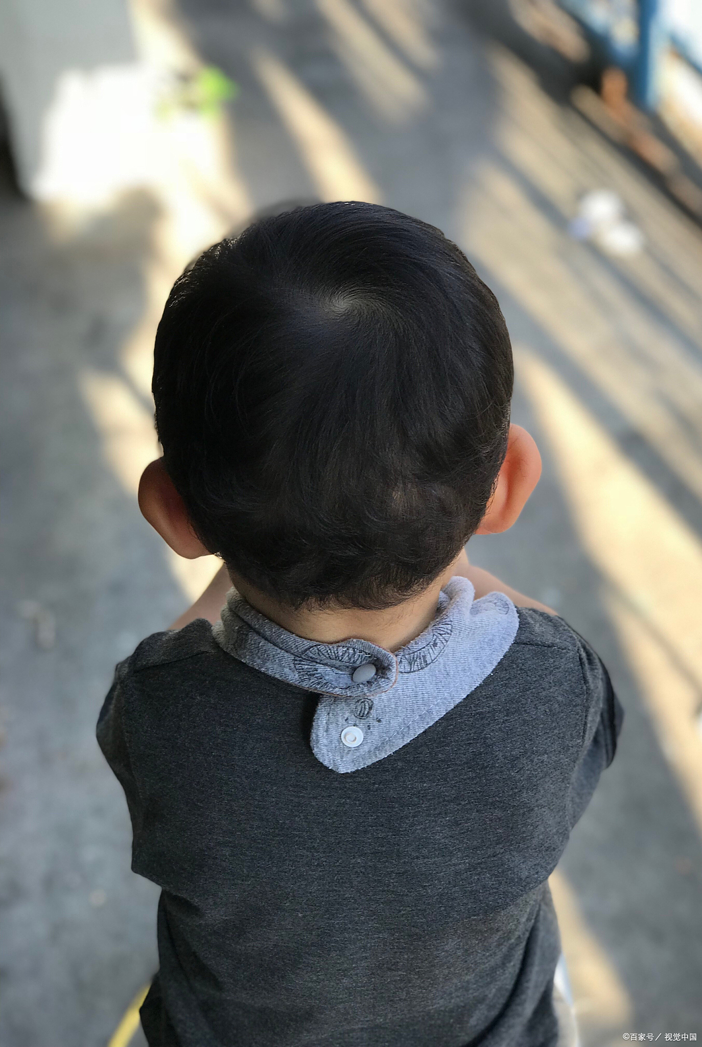 婴儿掉头发正常吗