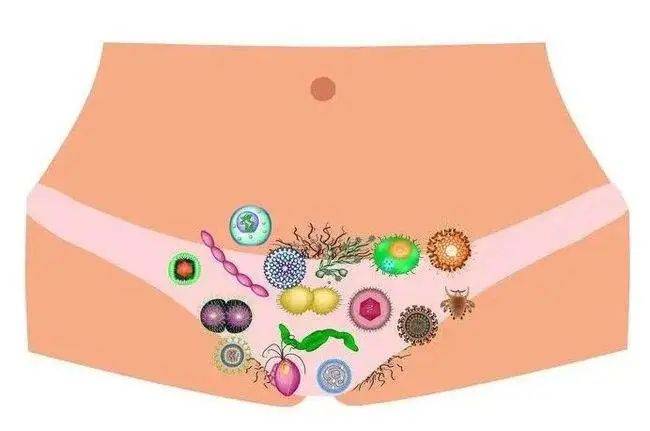 阴道加德纳菌是怎么引起的