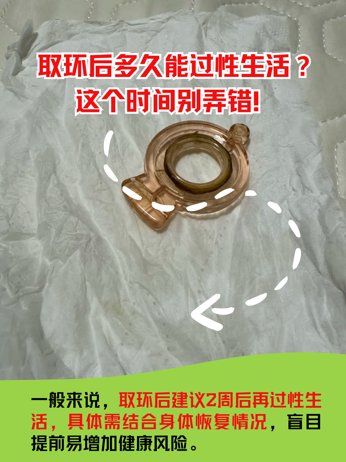 节育环多久换一次