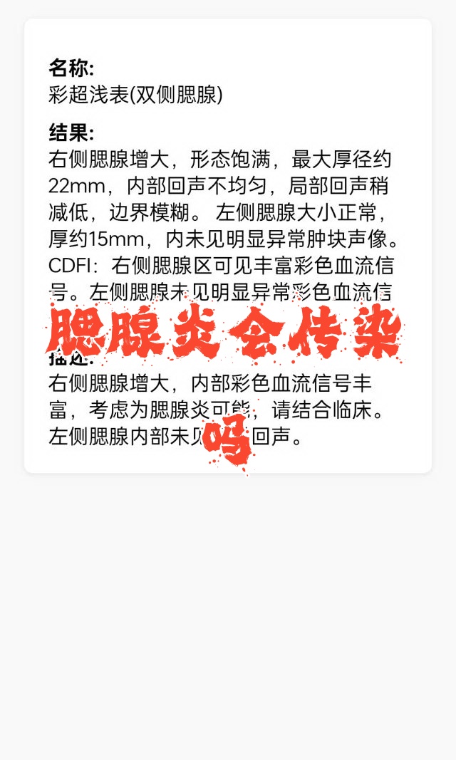 腮腺炎会传染吗?