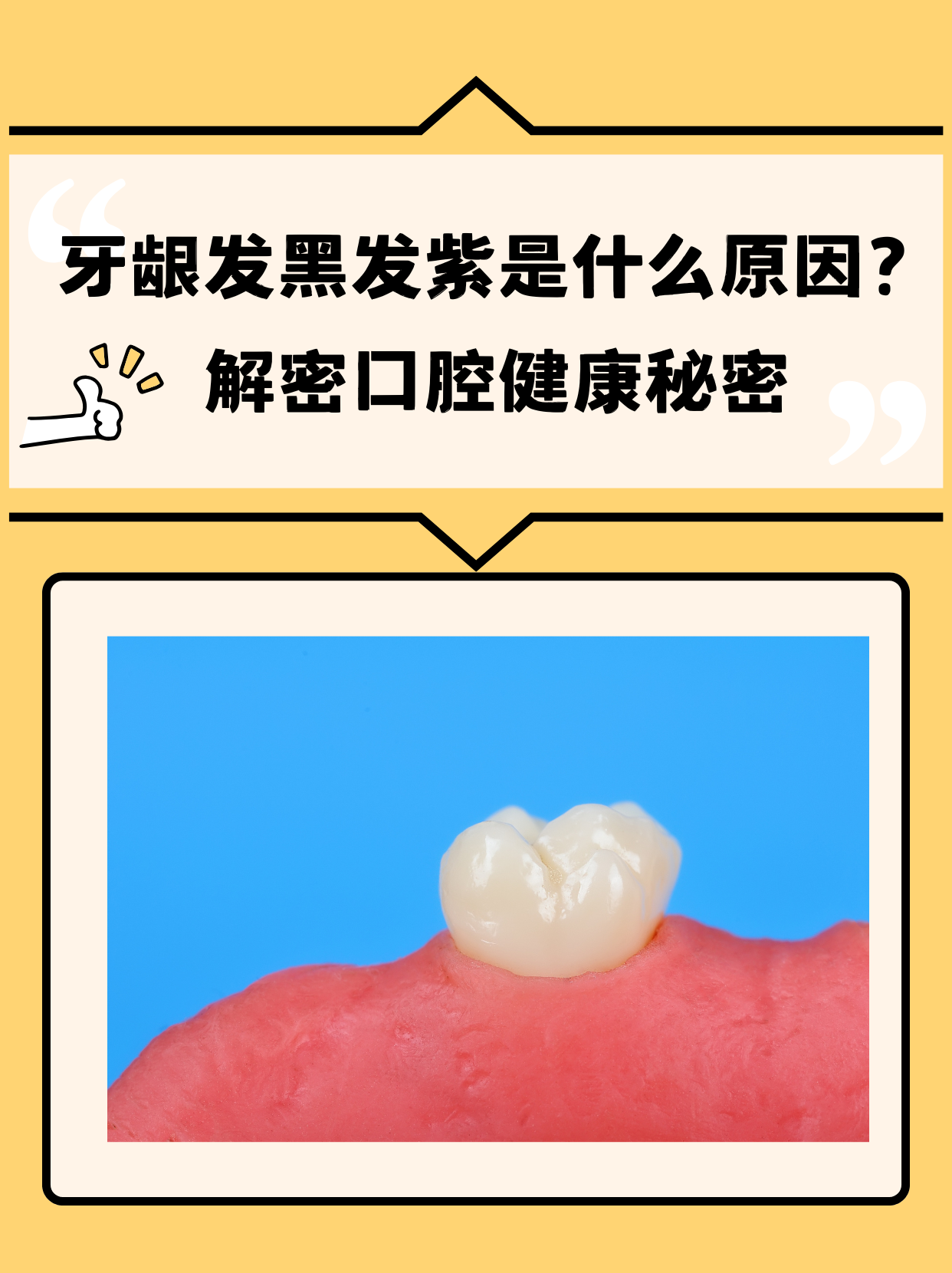 牙龈发黑是怎么回事