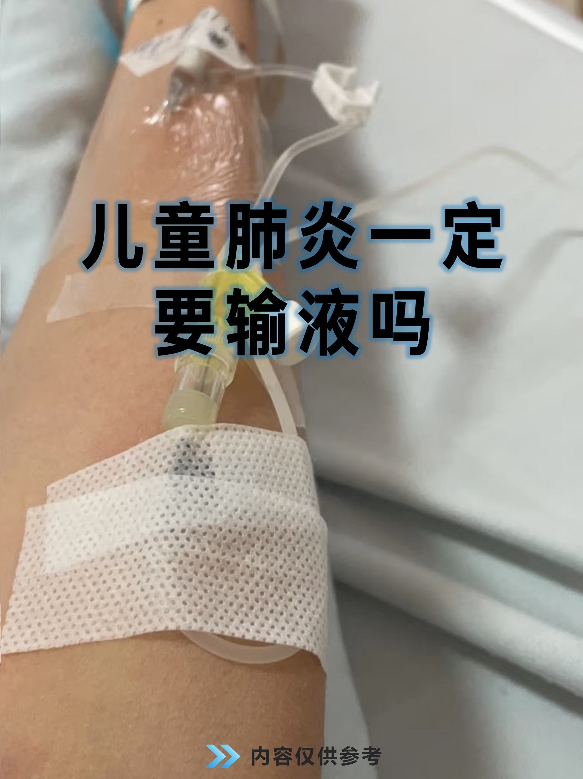 输液阿奇霉素最多几天