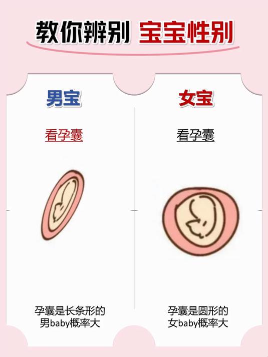 胎儿性别早知道