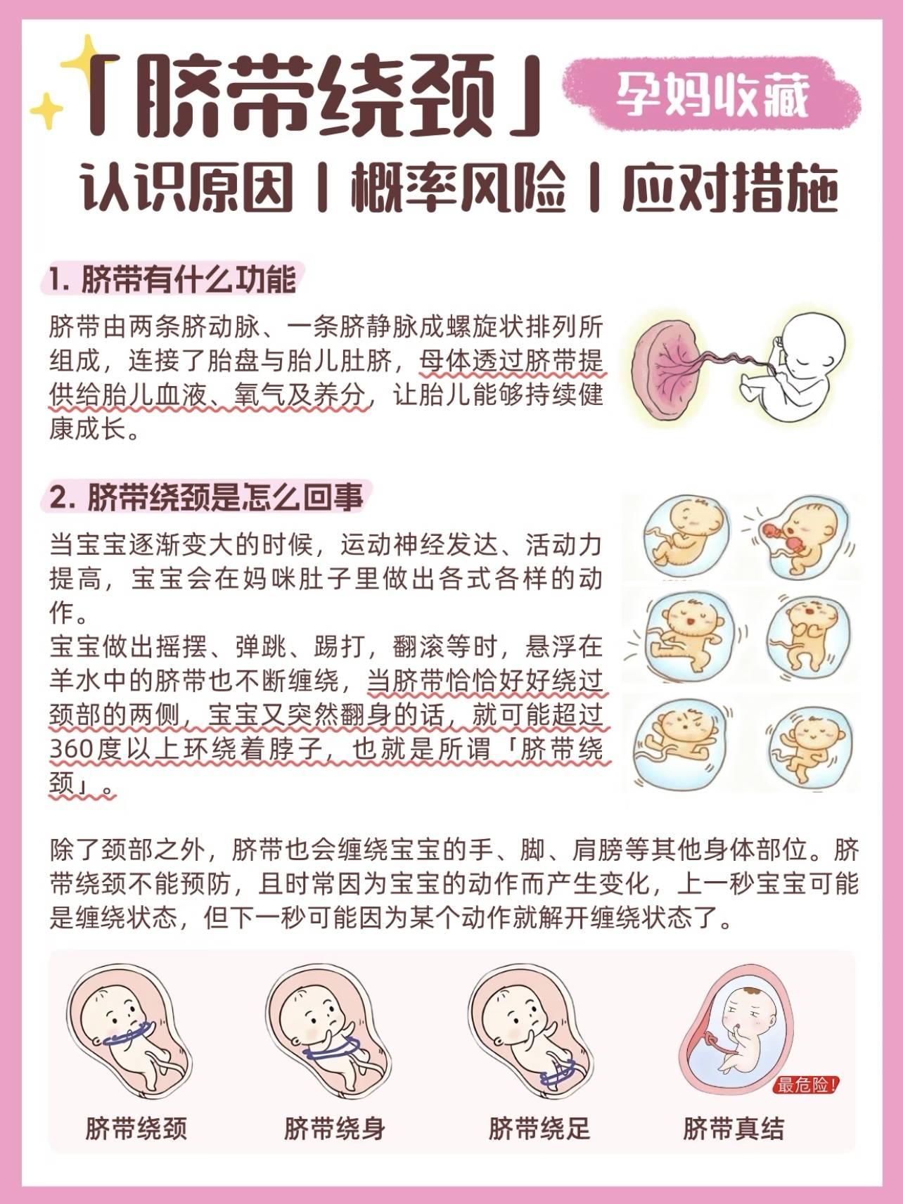 如何治疗脐带绕颈