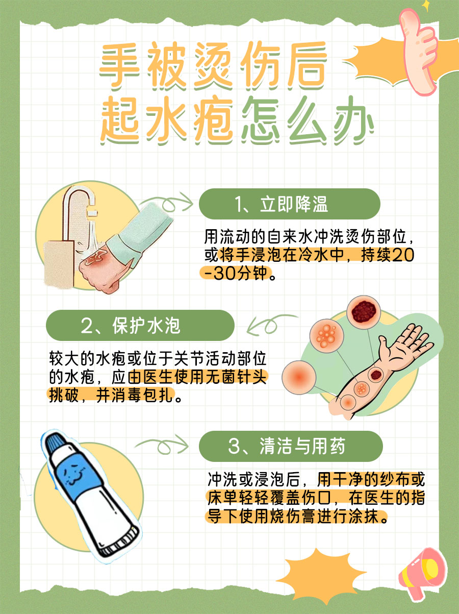 手指被开水烫到该怎么办