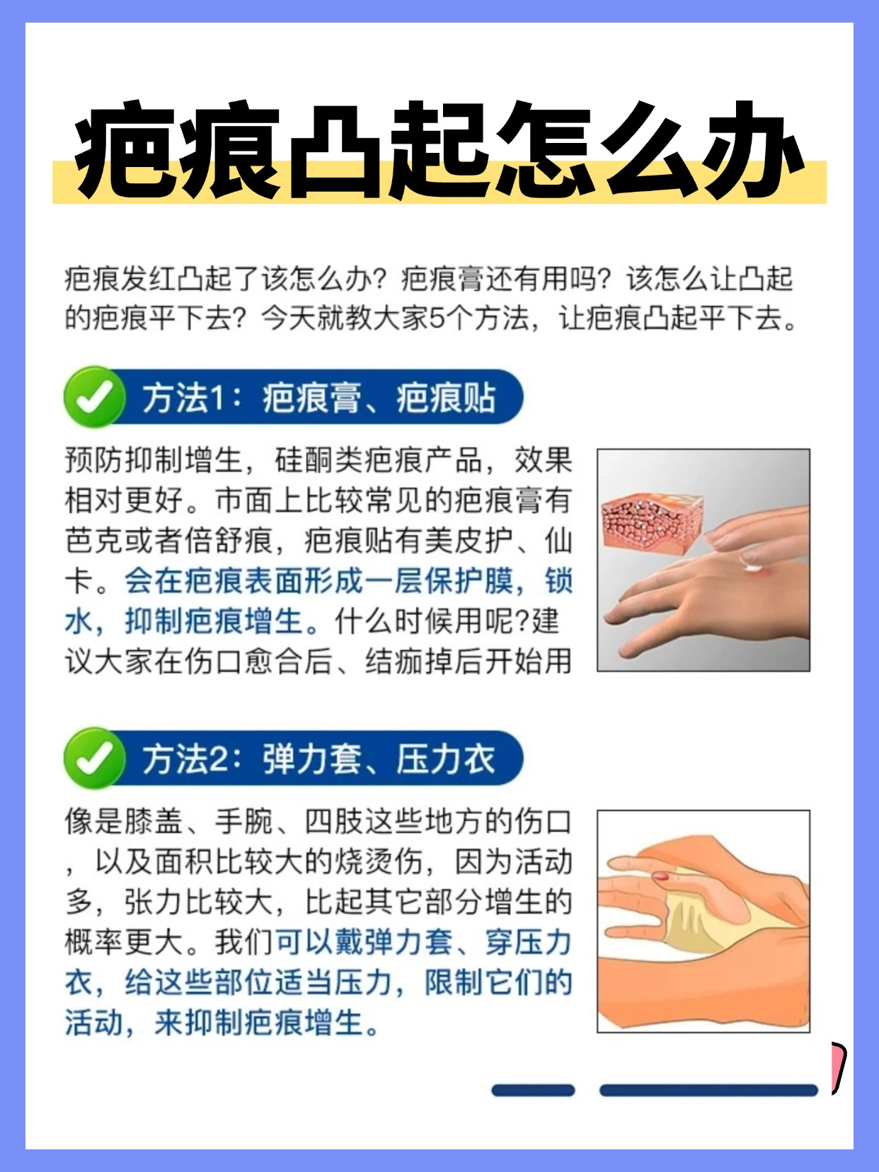 手术疤痕增生如何祛除