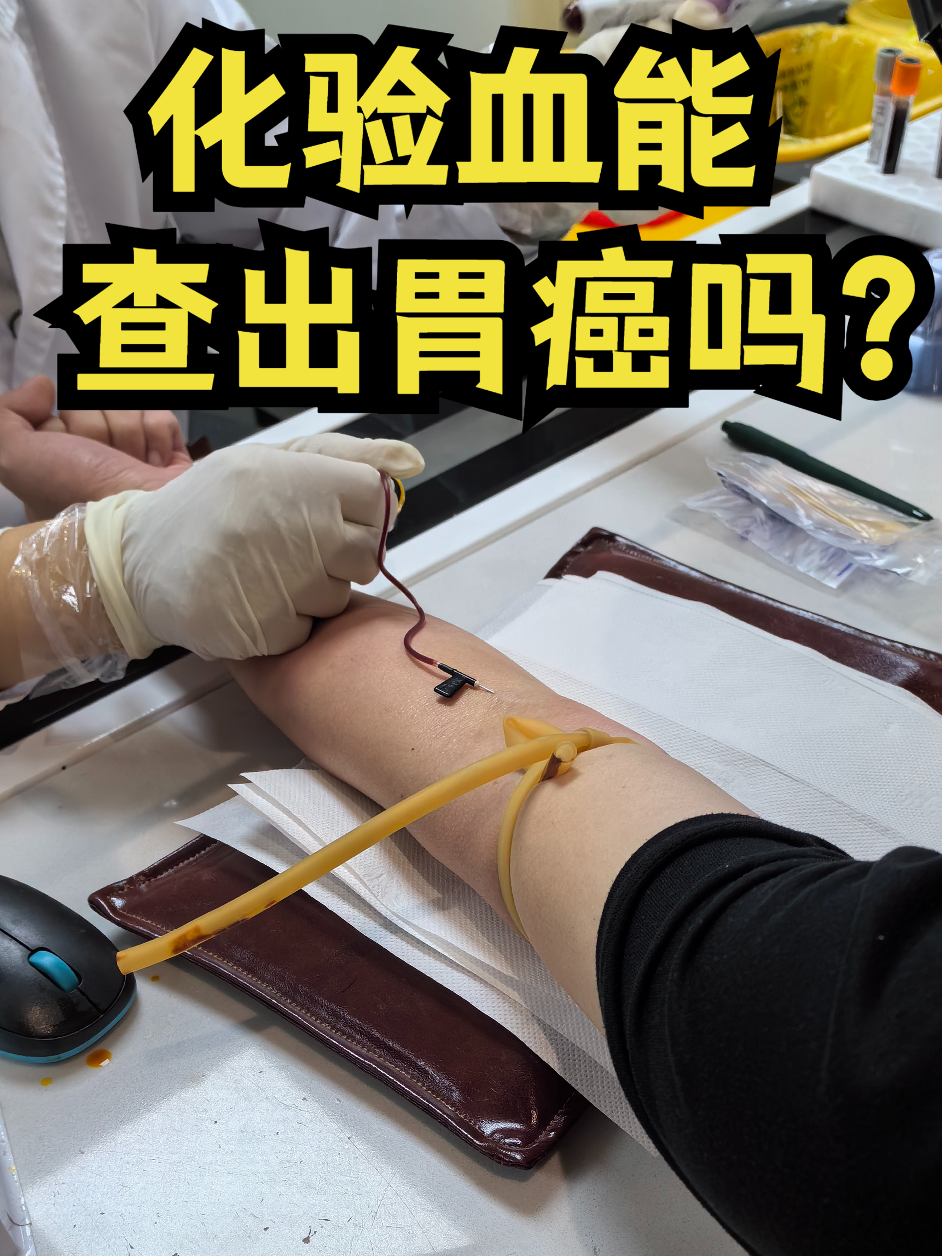 胰腺癌怎么检查最准