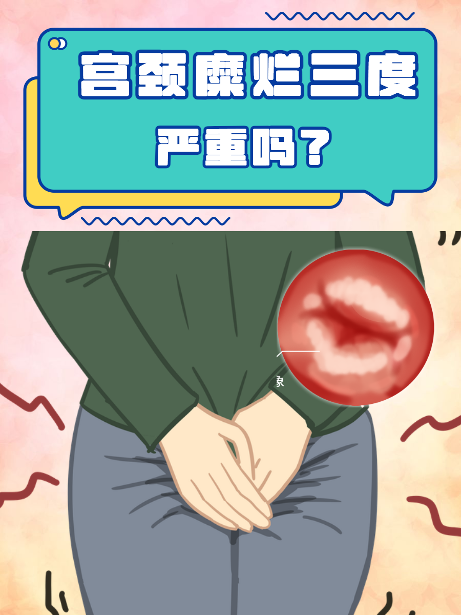 三度宫颈糜烂严重吗