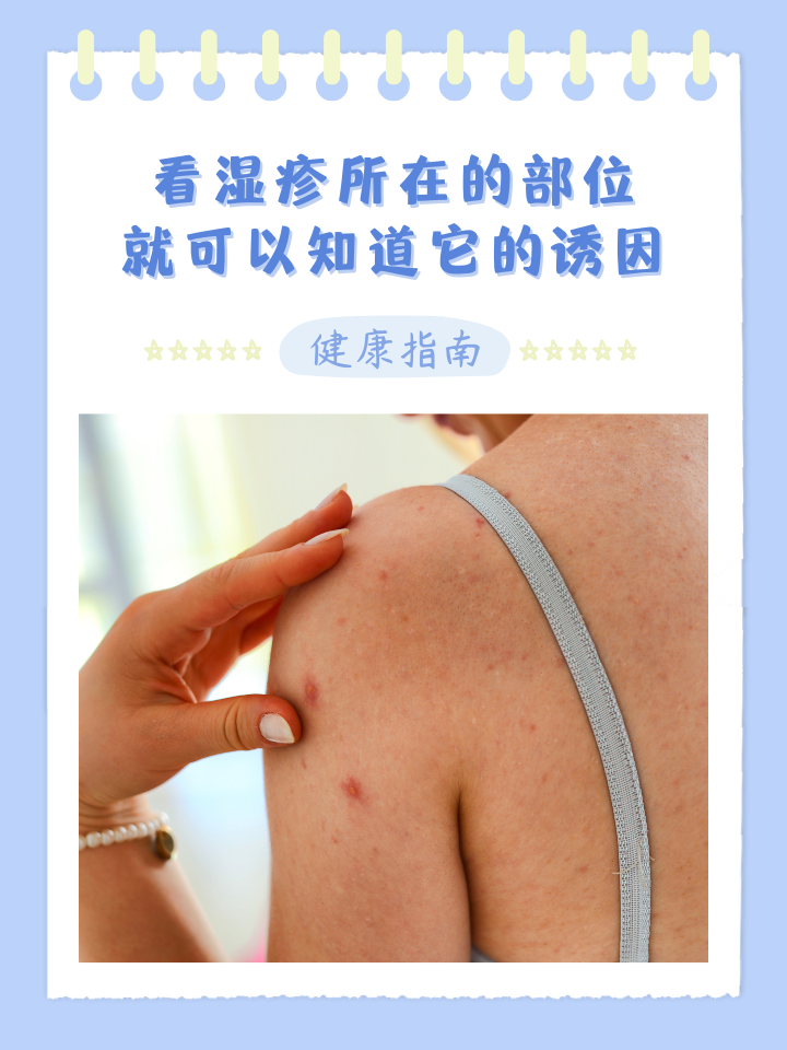 皮肤湿疹是怎么引起的