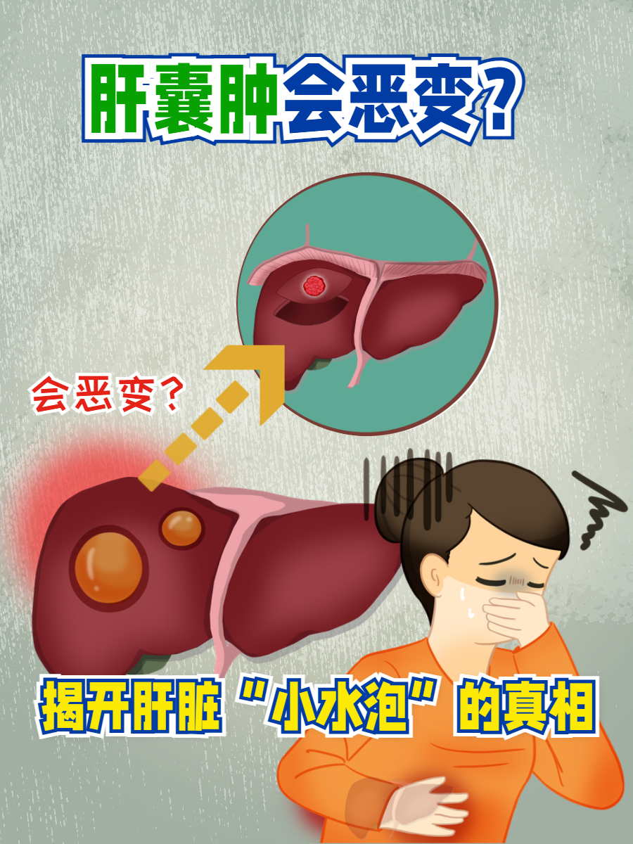 肝囊肿是怎么引起的?