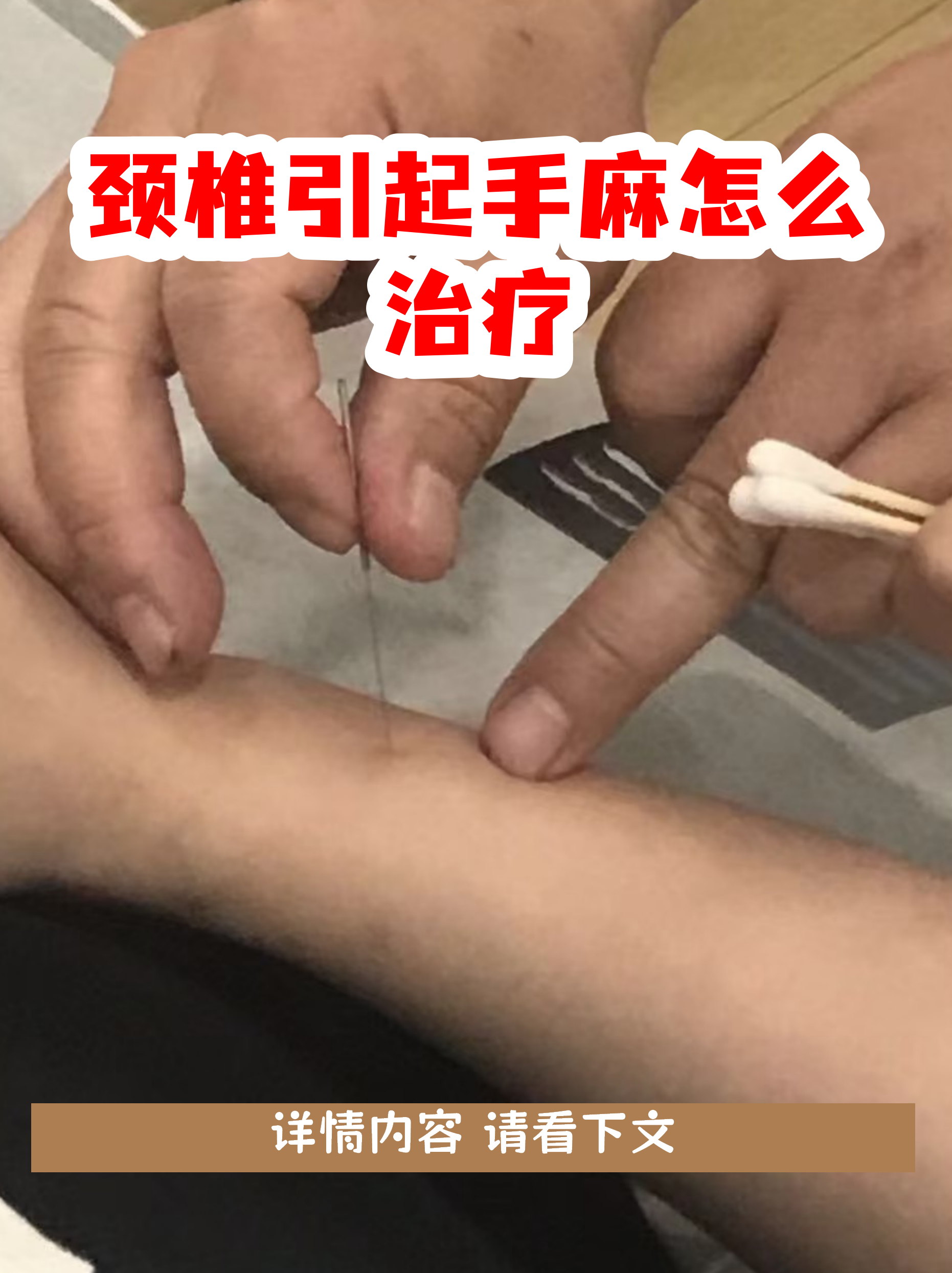 治疗手麻偏方