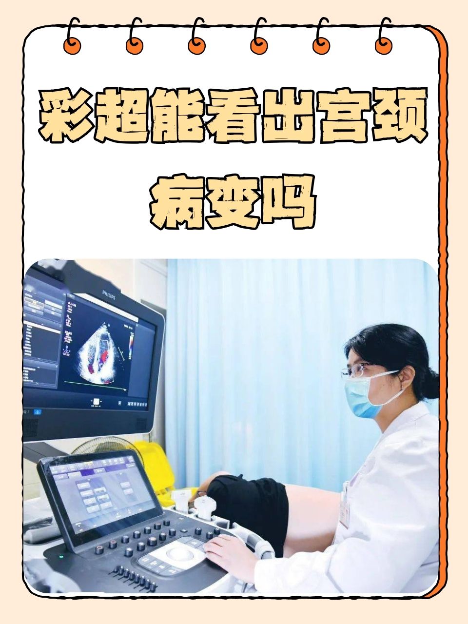 宫颈筛查是检查什么