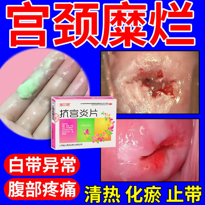 外阴瘙痒怎么治疗好