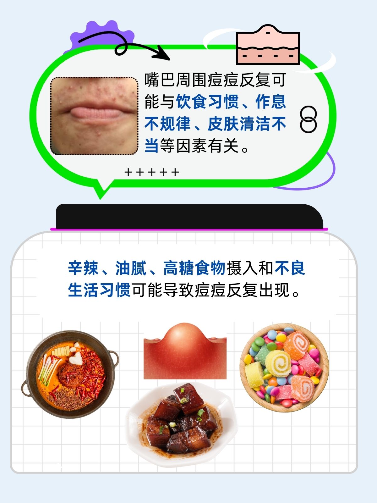 嘴唇周围反复长痘痘怎么办?