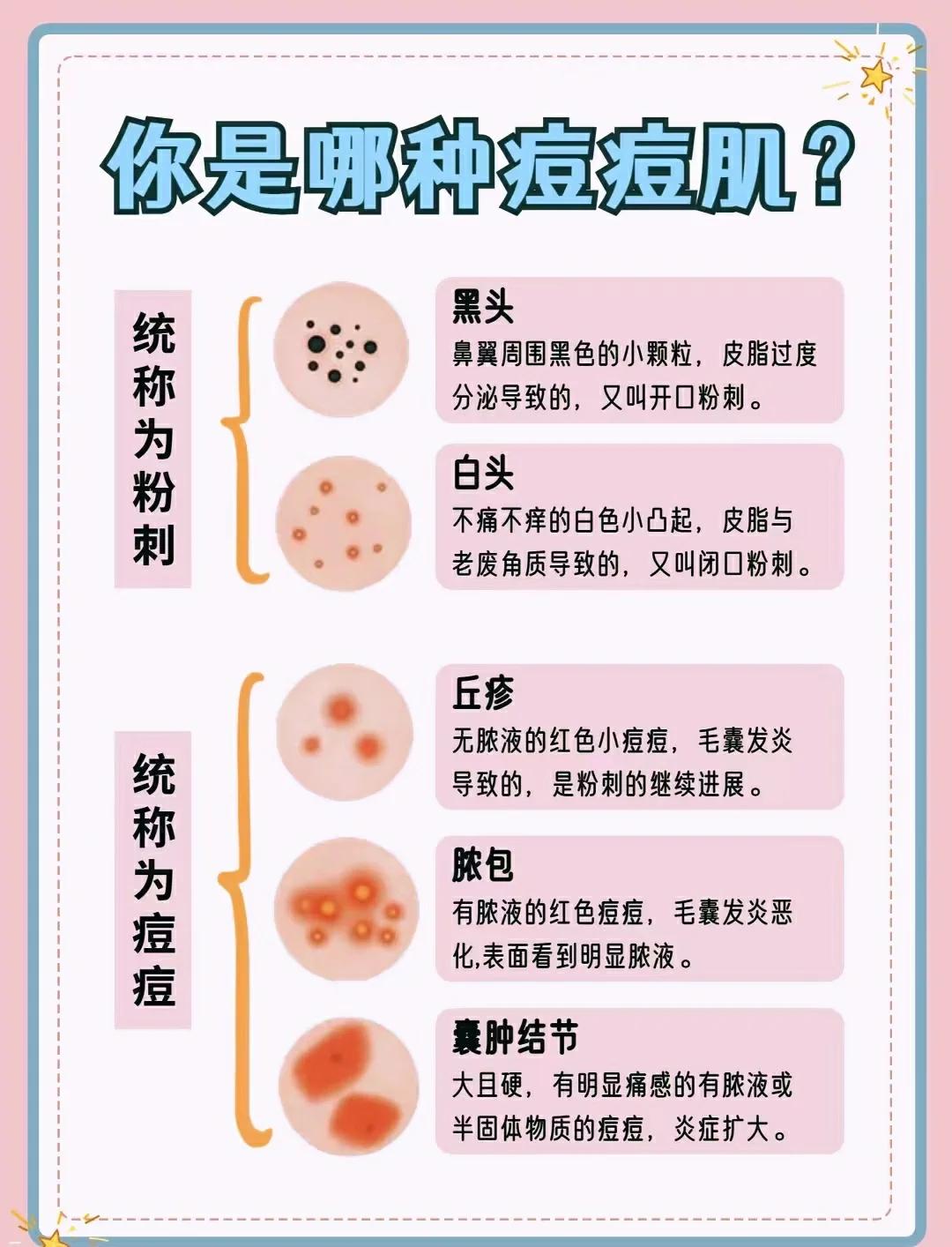 痤疮是什么意思