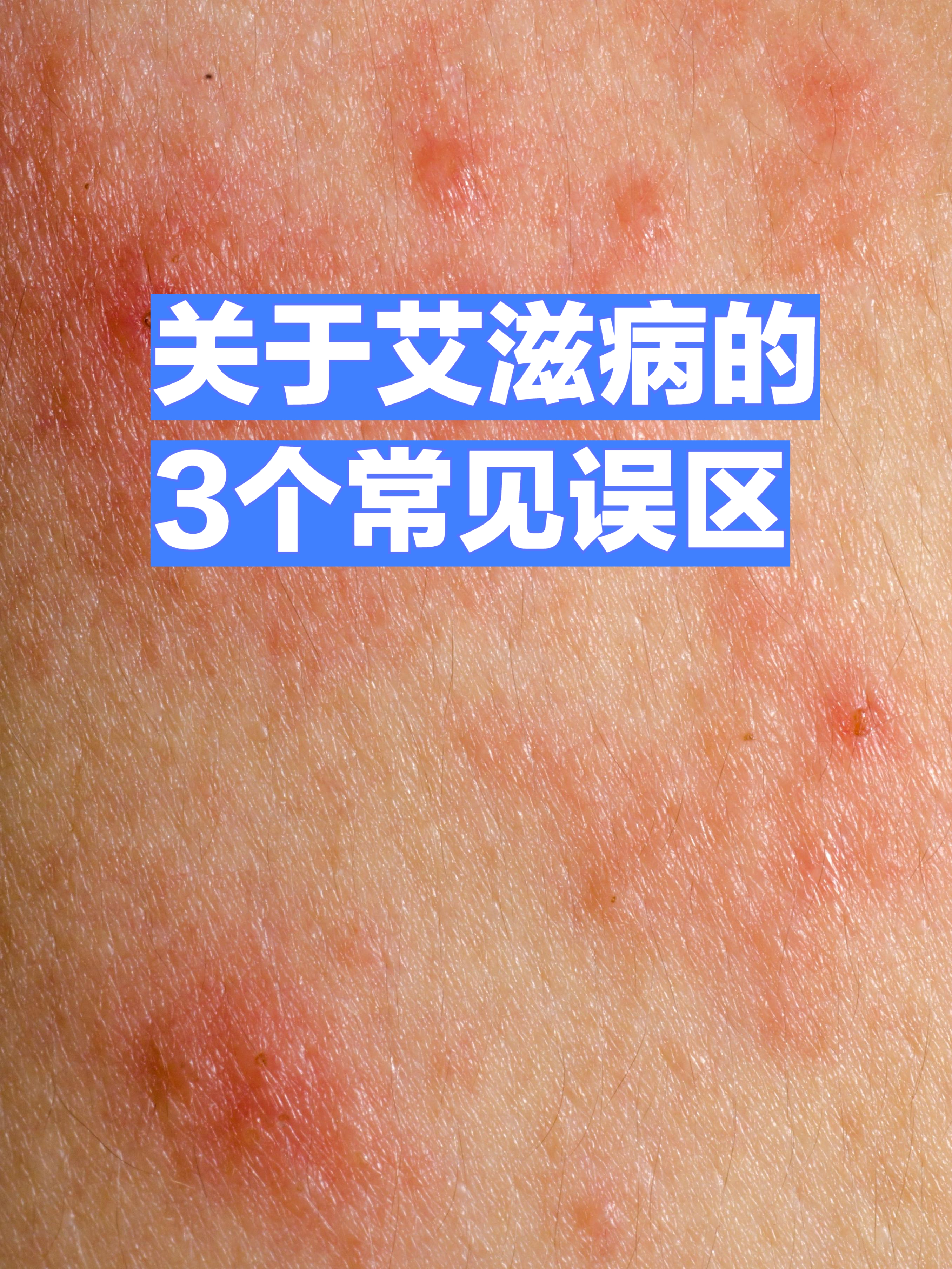 艾滋病的危害是什么