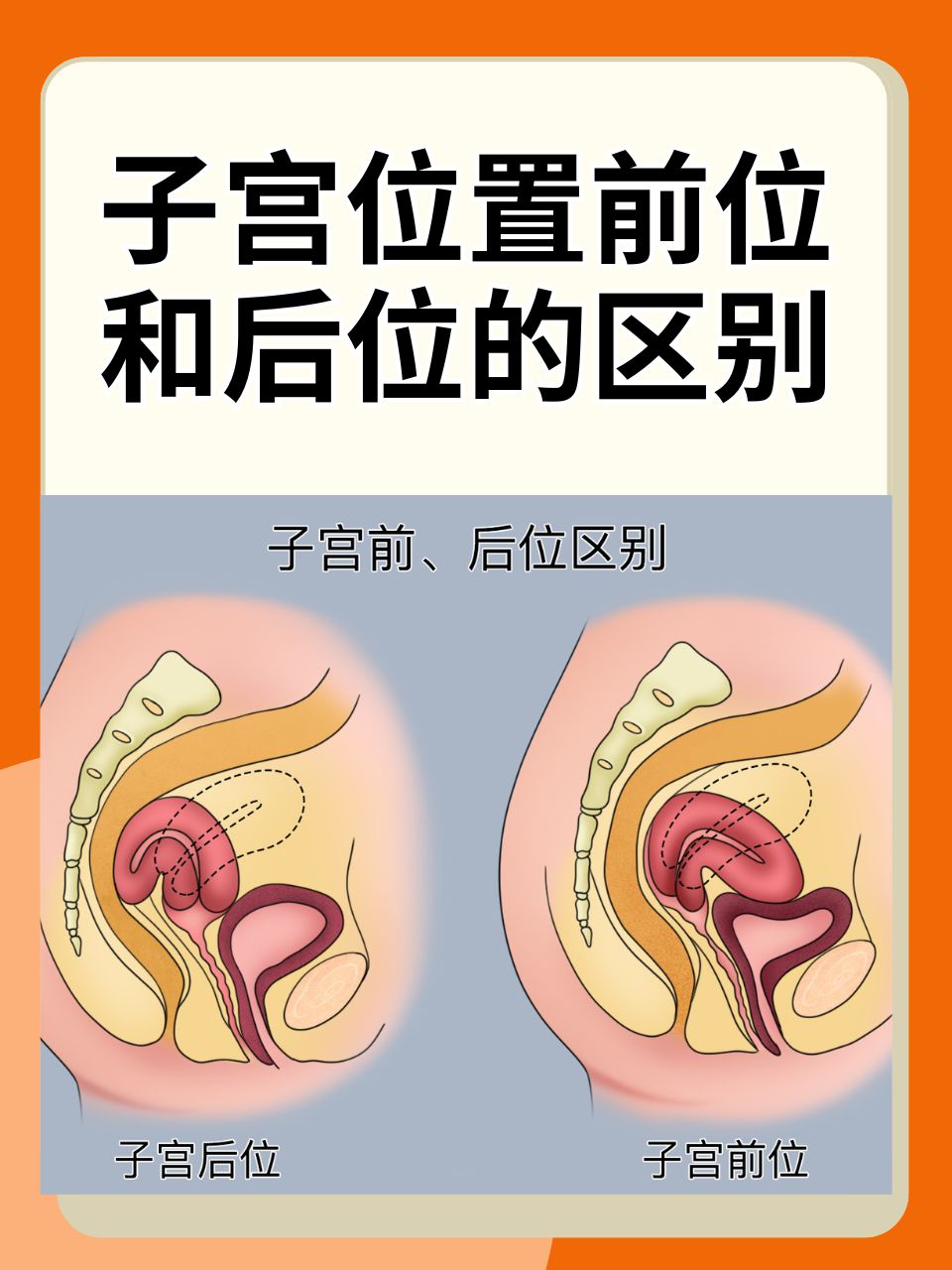 孕妇临盆子宫是什么样子