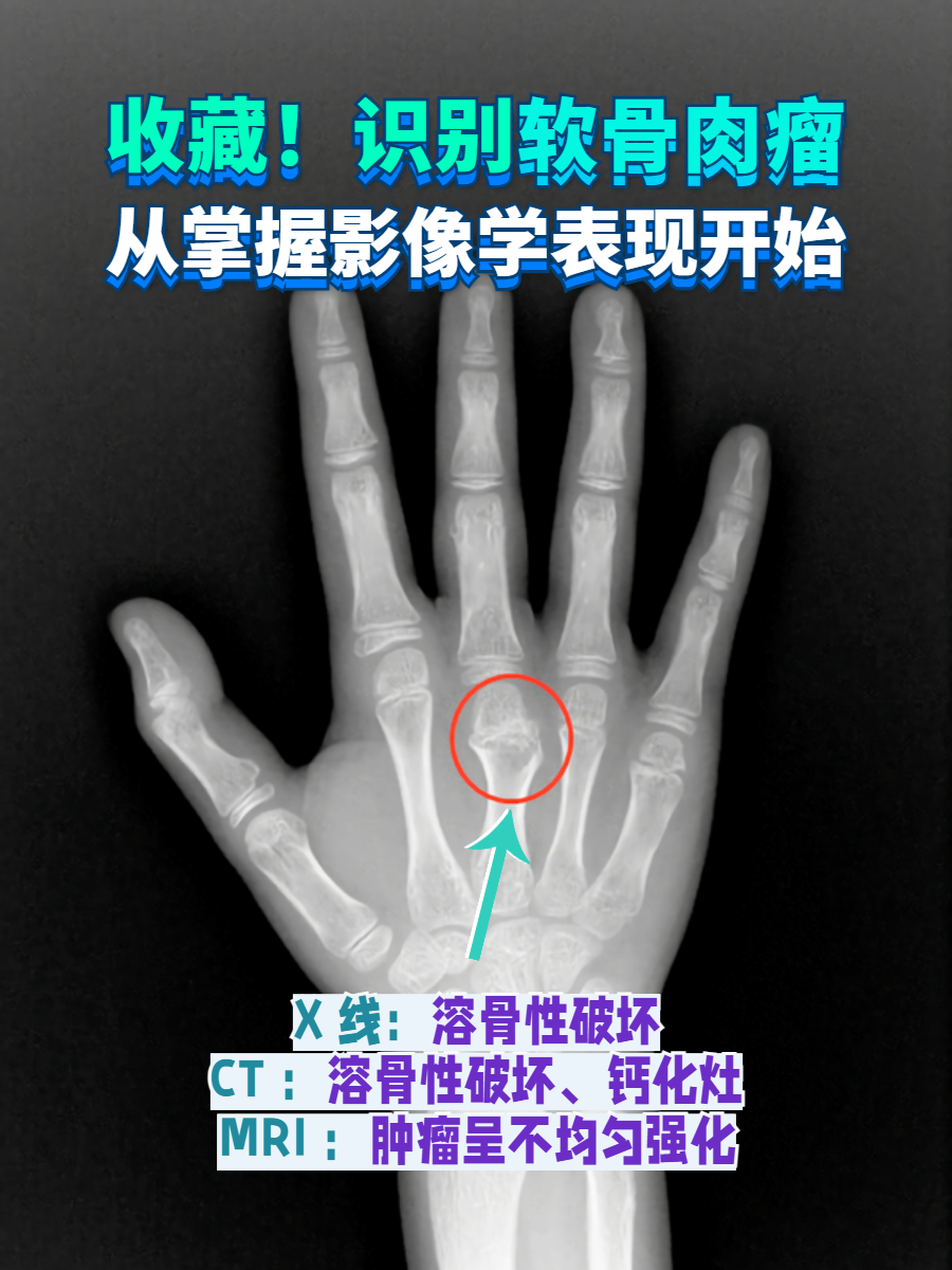这是一张左手x光片请问为什么两张图不一样骨骼线是闭