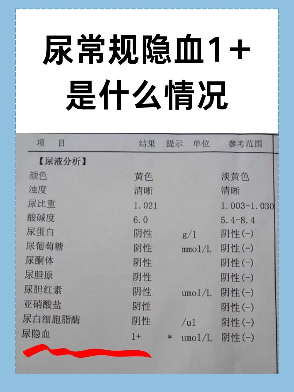 尿隐血弱阳性