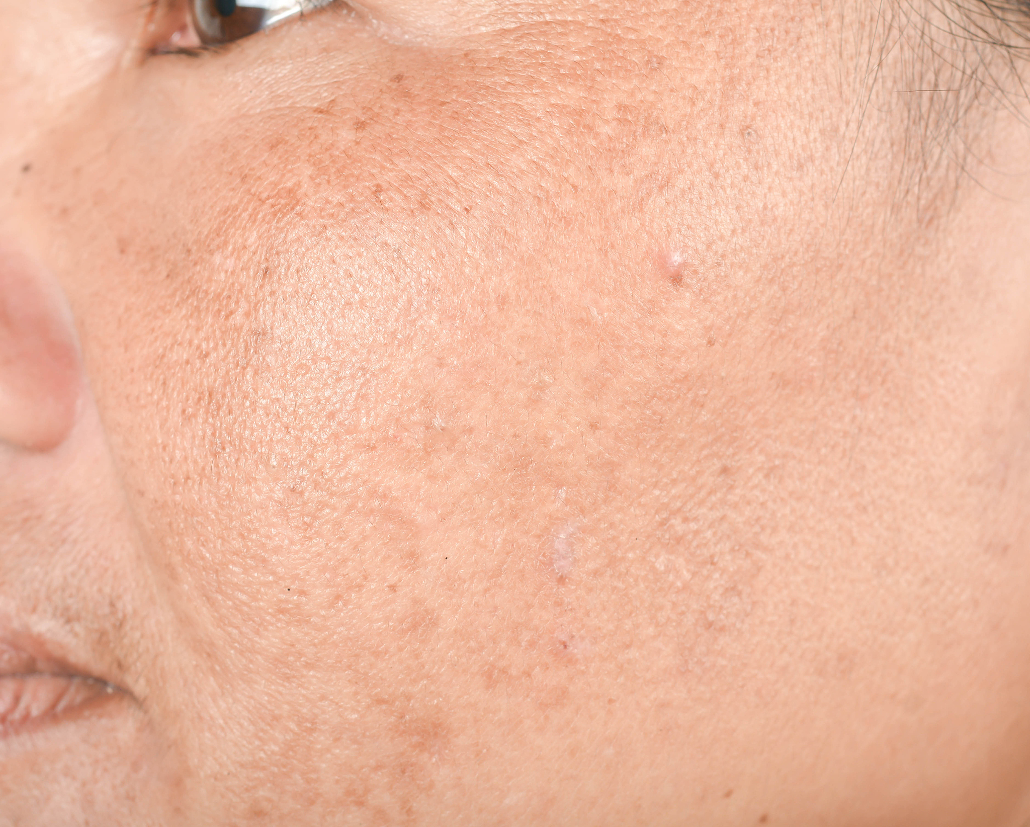 脸颊两侧发黑,什么原因