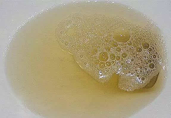 小便的时候发现有泡沫