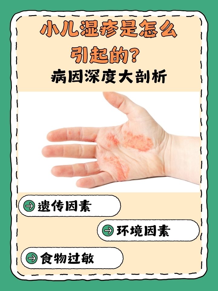 婴儿湿疹的原因是什么