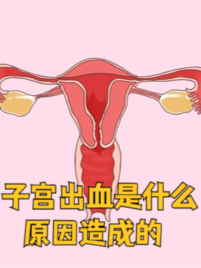 子宫出血是什么原因造成的