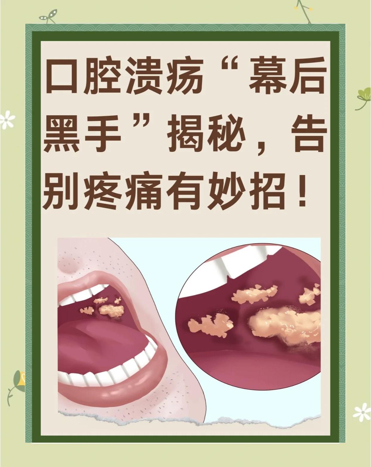 嘴里起泡怎么办?