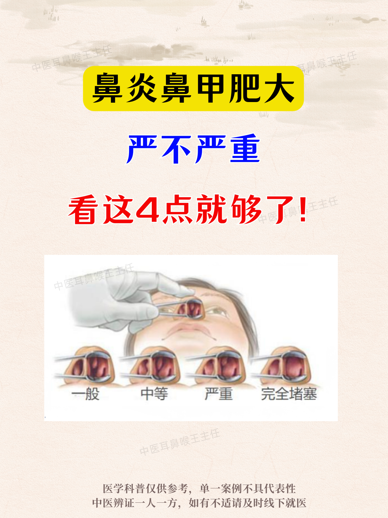 鼻甲肥大是一种怎么样的病?