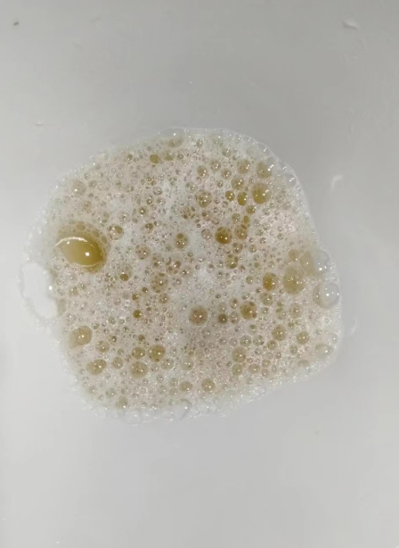 小便尿出白色液体正常吗