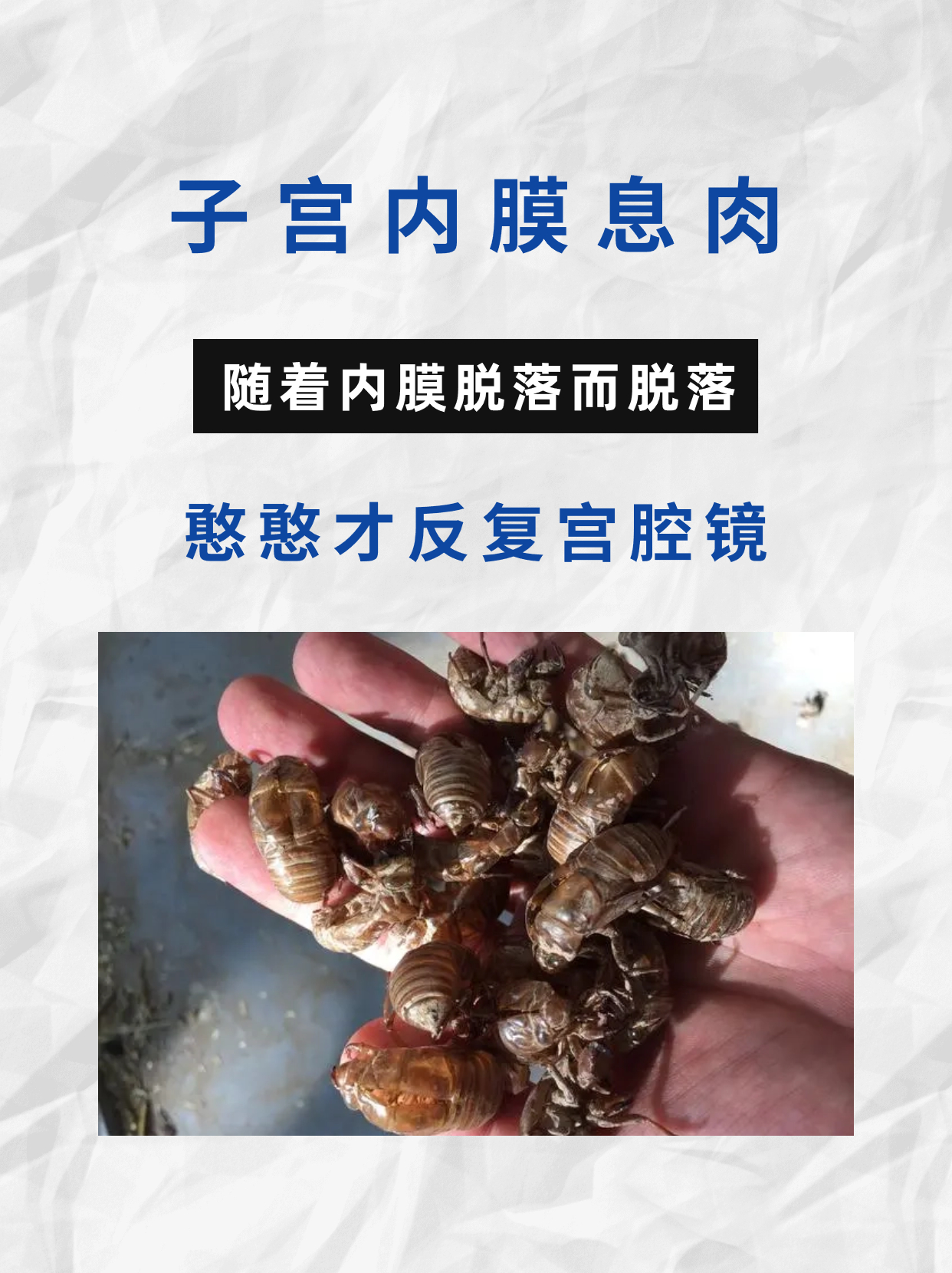 内膜息肉又叫子宫肌瘤吗